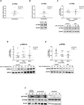 Interleukin-17a Induces Neuronal Differentiation of Induced-Pluripotent Stem Cell-Derived Neural Progenitors From Autistic and Control Subjects